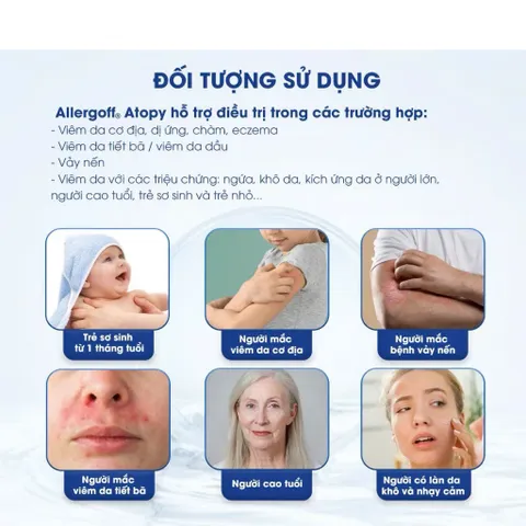 Kem Dưỡng Ẩm Allergoff Atopy Cream 75ml - Giúp Làm Dịu Da Khô, Ngứa, Kích Ứng - Sản Phẩm Dành Cho Da Nhạy Cảm