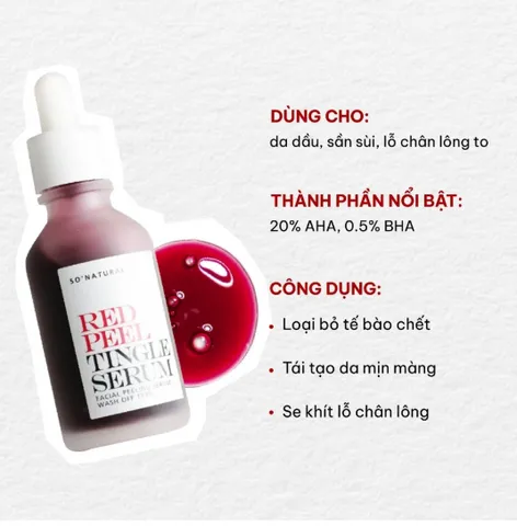 Tinh chất peel da So Natural Red Peel Tingle Serum 10ml