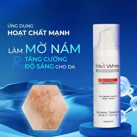 Kem Dưỡng Mờ Nám Trắng Da Max White Mesotech 30ml [Hàng Nhập Khẩu]