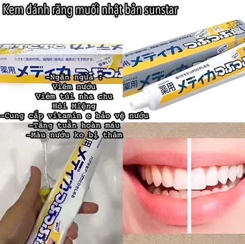 Kem Đánh Răng Muối Sunstar Nhật Bản 170g - Bảo Vệ Nướu, Trắng Răng, Hơi Thở Thơm Mát, Ngăn Ngừa Viêm Nướu