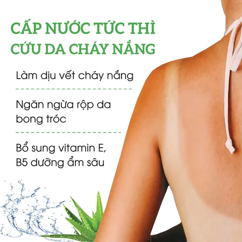Gel Dưỡng Ẩm Nha Đam Milaganics 270ml - Dưỡng Da Mềm Mại, Cấp Nước, Chống Lão Hóa với Vitamin E nhập khẩu Việt Nam