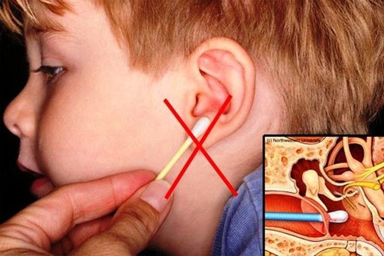 [TIPS] Sử dụng máy hút ráy tai Nhật Bản để giữ an toàn thính giác cho bạn và người thân