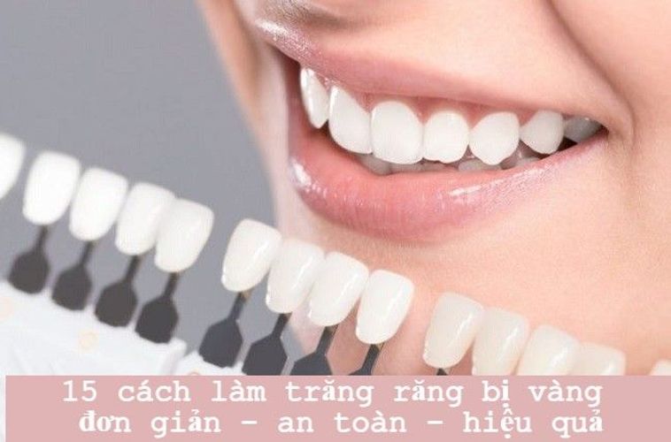 15 cách làm trắng răng bị vàng tại nhà đơn giản - hiệu quả - an toàn