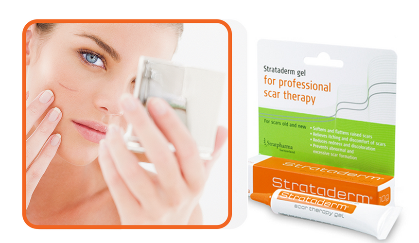 Strataderm -  Kem hỗ trợ cải thiện sẹo lồi của Thụy Sĩ 1