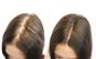 Viên Uống Hỗ Trợ Giảm Rụng Tóc Martiderm Hair System Anti Hair
