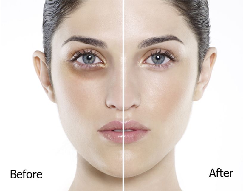 Kumargic eye gi&uacute;p đ&aacute;nh bay c&aacute;c qu&acirc;ng th&acirc;m mắt đ&aacute;ng gh&eacute;t
