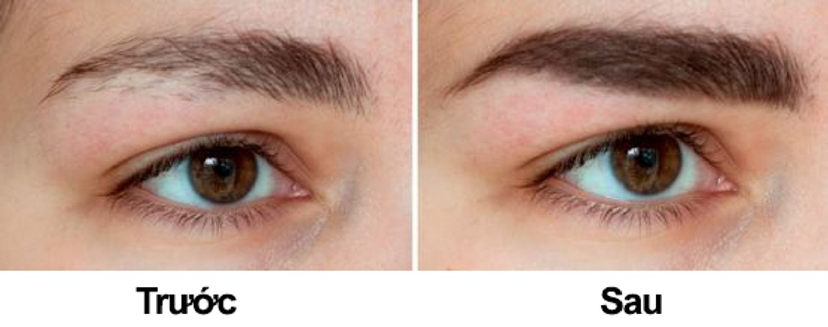 Trước v&agrave; sau khi sử dụng thuốc mọc l&ocirc;ng m&agrave;y Kaminomoto