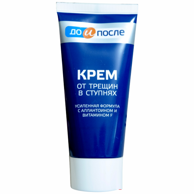 Kem trị nứt g&oacute;t ch&acirc;n của Nga Apteka vitamin F gi&uacute;p giữ ẩm l&agrave;m mềm da