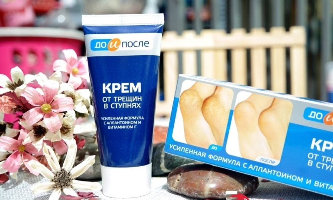 Kem trị nứt g&oacute;t ch&acirc;n của Nga Apteka l&agrave;m liền vết nứt g&oacute;t ch&acirc;n, cung cấp độ ẩm, dưỡng da mềm mịn