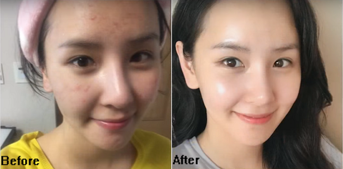 Serum Balance Hyaluronic Deep Moisture gi&uacute;p da đủ nước trở n&ecirc;n căng b&oacute;ng, tươi trẻ