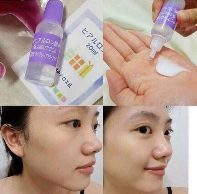 Th&agrave;nh phần Hyaluronic Acid gi&uacute;p cấp ẩm để da trở n&ecirc;n căng b&oacute;ng