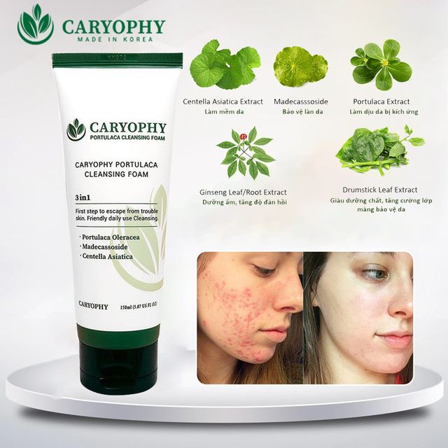 Sữa rửa mặt cho da mụn v&agrave; da nhạy cảm Caryophy ch&iacute;nh h&atilde;ng