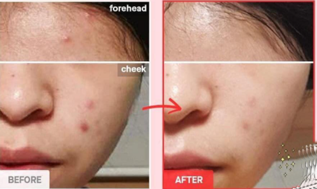 Sữa rửa mặt tạo bọt Cosrx AC Collection Calming Foam Cleanser 150ml