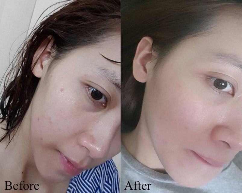 Đ&aacute;nh gi&aacute; Serum SRV
