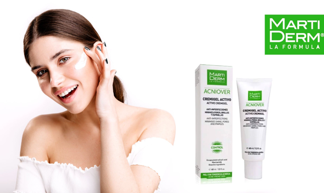 kem dưỡng cho da dầu mụn Martiderm Acniover Active Cremigel&nbsp;