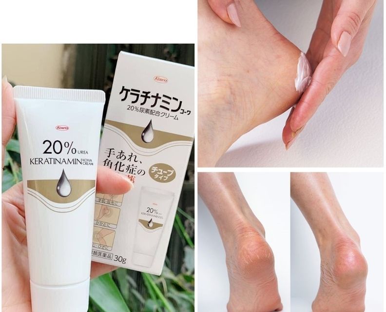 Hỗ trợ cải thiện c&aacute;c vấn đề vi&ecirc;m da cơ địa, &aacute; sừng hiệu quả