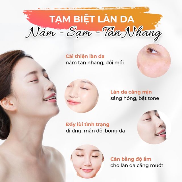 Kem Hỗ trợ Ngừa N&aacute;m T&agrave;n Nhang Oriskin Melasma Whitening Cream 1