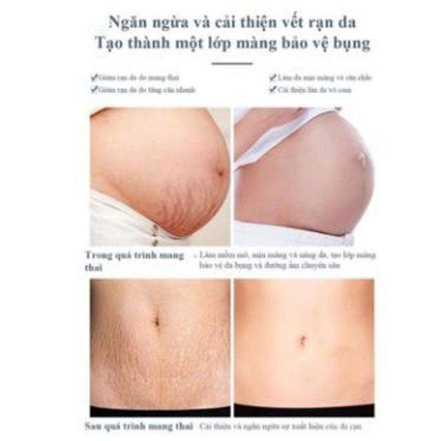 Gel Nghệ Cocayhoala giúp giảm rạn da, mờ thâm 2