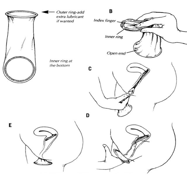 Bao Cao Su Nữ Giới Mỏng Trơn Female Condom - 2s 3