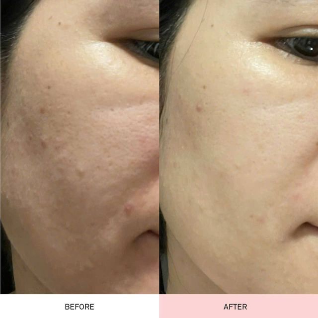 Bảo vệ da khỏi t&aacute;c hại của &aacute;nh nắng