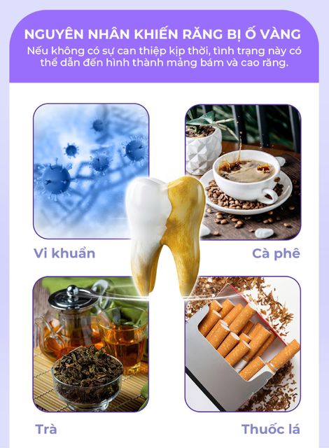 image product content 4