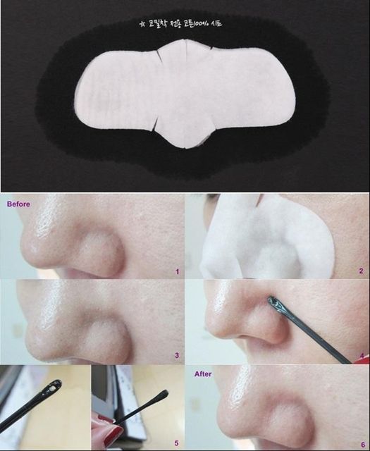 Miếng Đẩy Mụn Đầu Đen Ciracle Goodbye Blackhead 2