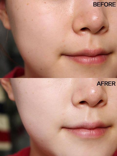Nước Dưỡng Angel's Liquid Angel's Liquid&nbsp;Esscense Glutathione 7 Day 3
