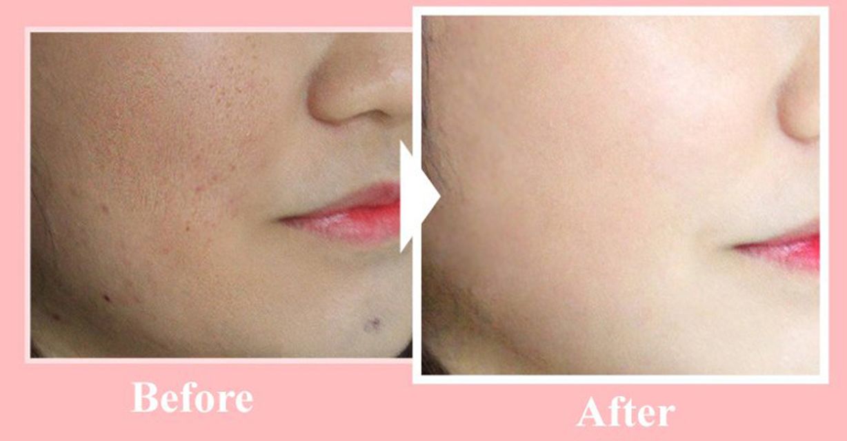 Phấn Nước Real Cover Pink Cushion SPF50+/Pa+++ 20g (Ph&acirc;n Phối Bởi Nh&agrave; B&aacute;n H&agrave;ng)