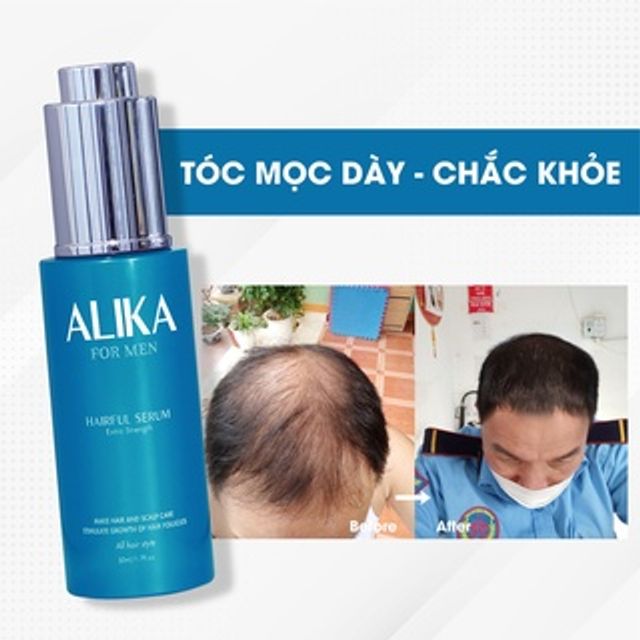 Tinh Chất Hỗ Trợ Kích Thích Mọc Tóc Alika Cho Nam 2