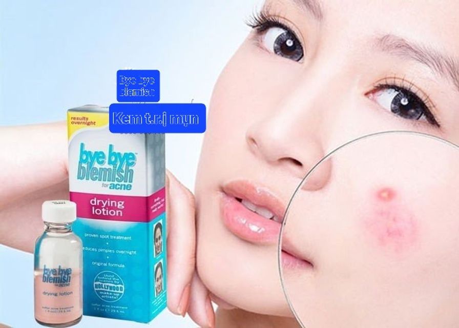 Chấm mụn Bye Bye Blemysh Giảm Mụn Cấp Tốc Mỹ -28ml 2