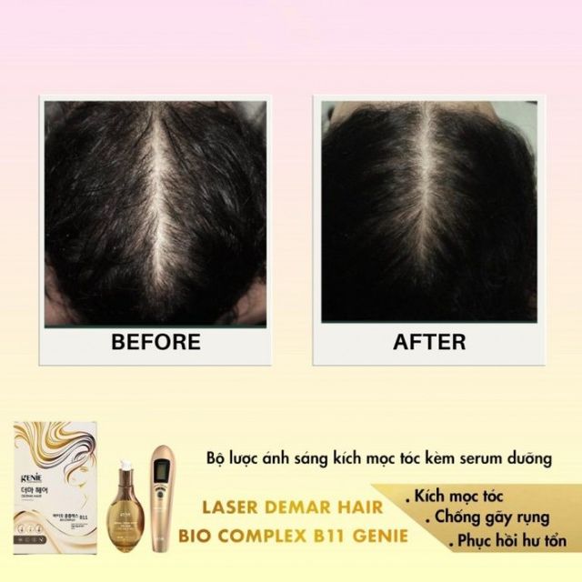 image product content 10