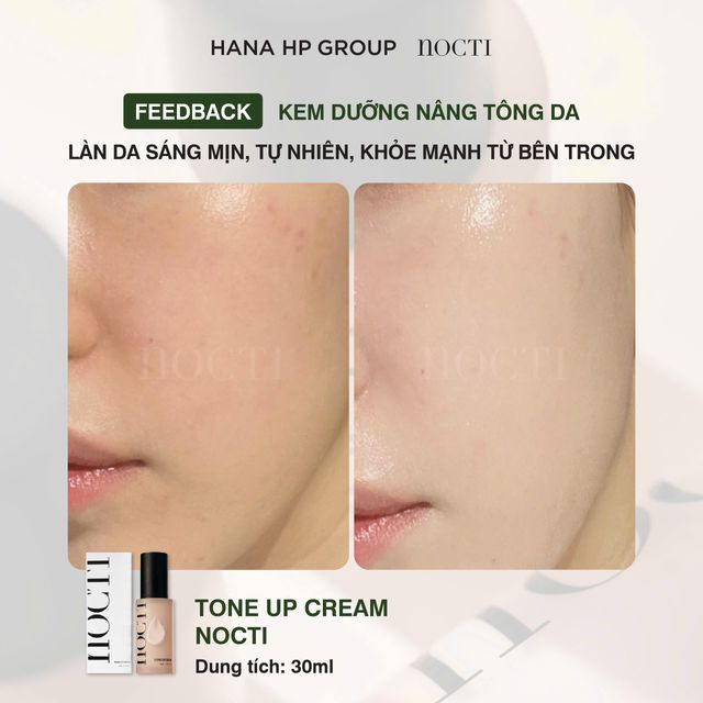 Kem dưỡng N&acirc;ng tone chu&acirc;̉n hàn Nocti 30ml