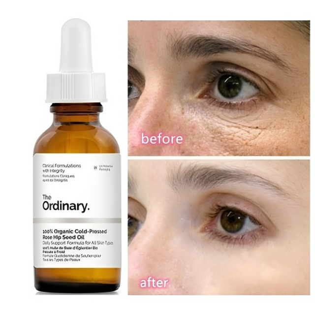 Serum The Ordinary 100% Organic Cold-Pressed Rose Hip Seed Oil