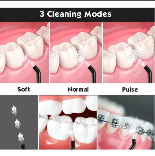 M&aacute;y tăm nước Mospro