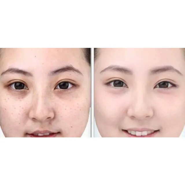 H&igrave;nh ảnh kem dưỡng ẩm Haku Shiseido HAKU Melano Deep Moisture