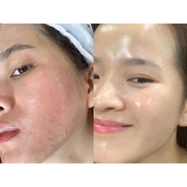 Kem Dưỡng Phục Hồi Evenswiss Rich Regenerating Cream 10ml