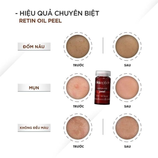 Tinh chất Peel da Ekseption Retin-oil 5ml - H&igrave;nh ảnh 5