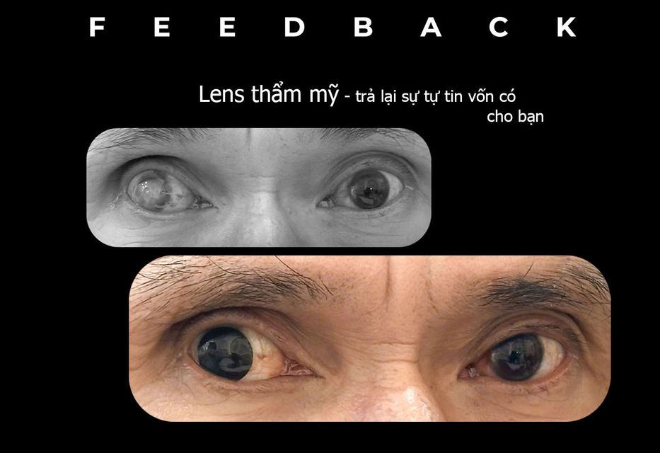 image product content 6