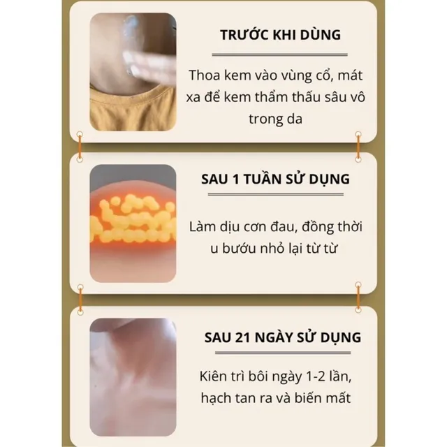 Kem Tan Hạch Bạch Huyết Nhật Bản