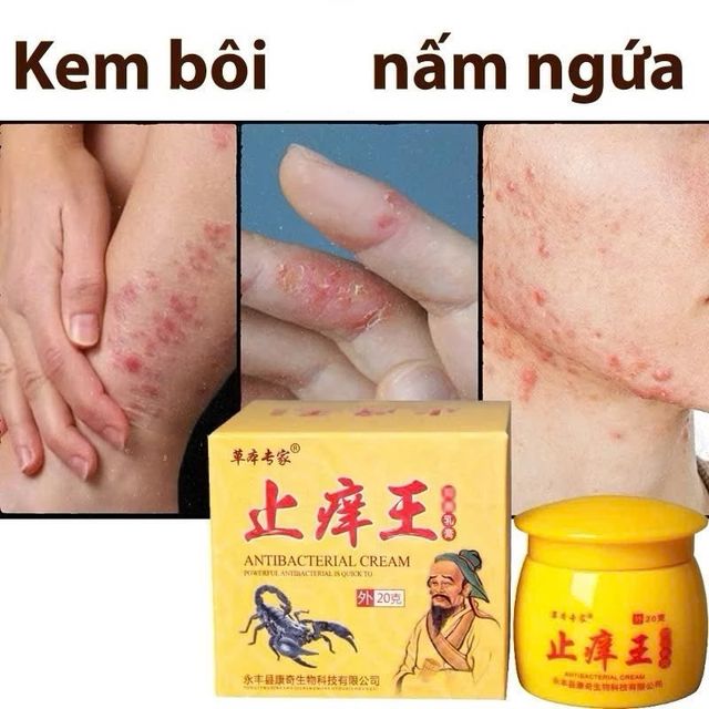 Kem B&ocirc;i Nấm ngứa Bọ Cạp V&agrave;ng &Ocirc;ng Gi&agrave;