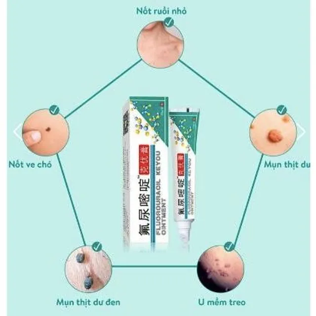 Kem Rụng Mụn Thịt Dư Keyou