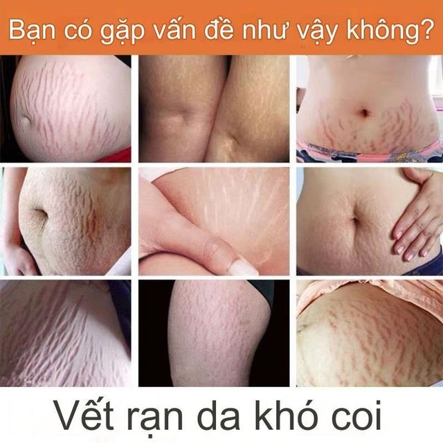 Kem dưỡng da