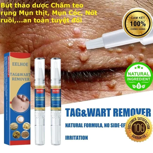 B&uacute;t Chấm Mụn C&oacute;c, Nốt Ruồi, Mụn Thịt Thừa