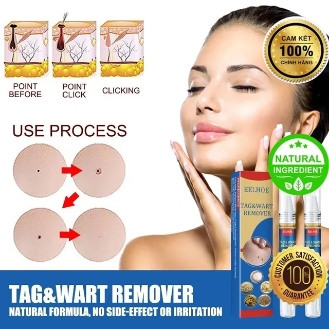Hướng dẫn sử dụng B&uacute;t Chấm Mụn C&oacute;c