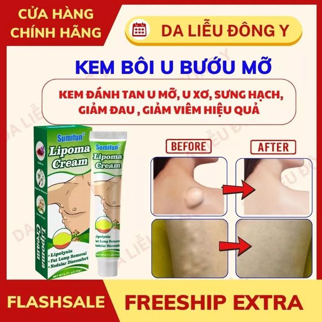 Kem b&ocirc;i tan u mỡ thảo mộc Sumifun
