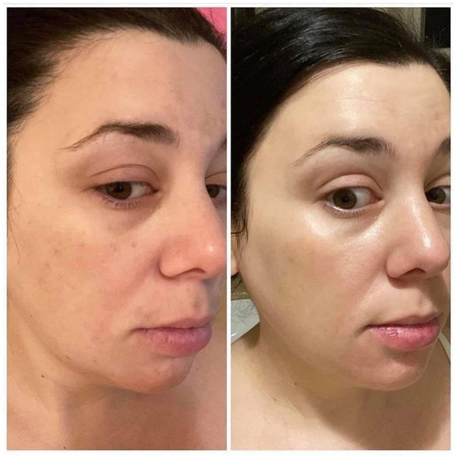 Serum PIGM 400 BR Biologique Recherche 30ml Giảm N&aacute;m V&agrave; L&agrave;m S&aacute;ng Da