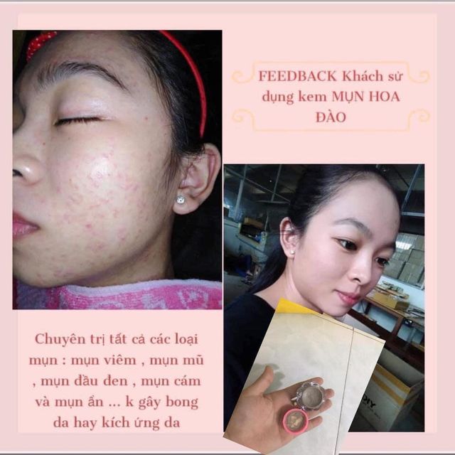 image product content 2