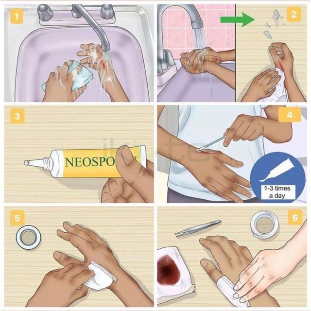 Kem mỡ Neosporin + Pain Relief tr&ecirc;n tay