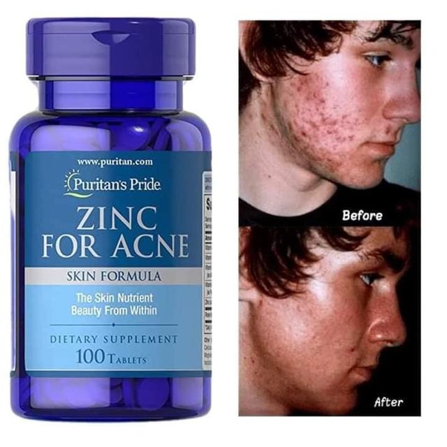 Vi&ecirc;n uống Kẽm Puritan&rsquo;s Pride Zinc - Hỗ trợ đẹp da
