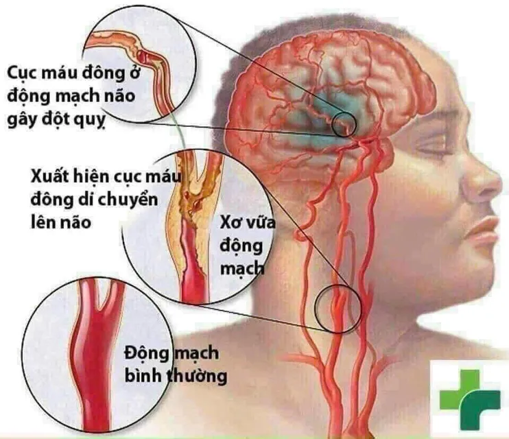 Vi&ecirc;n uống bổ tim mạch Qunol Ultra CoQ10 100mg